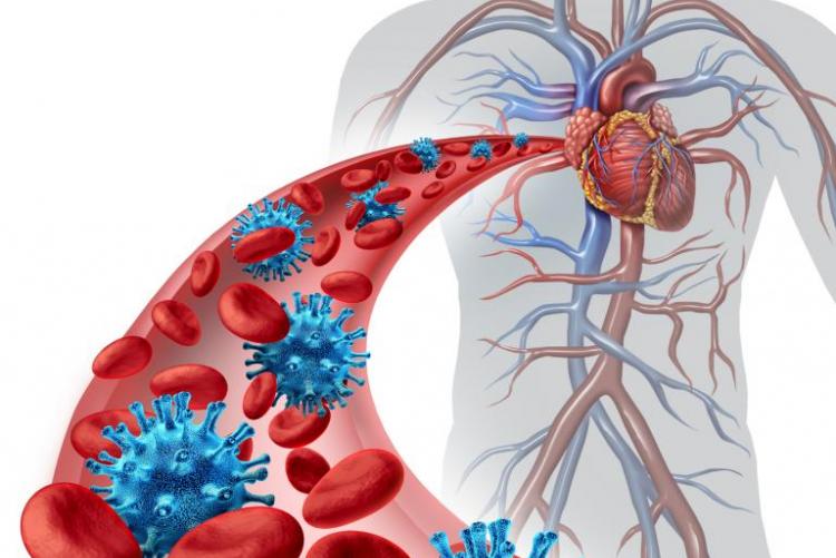 HIV-Associated Cardiovascular Disease