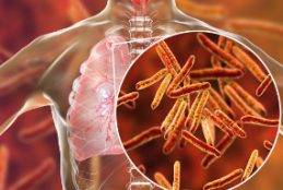 Tuberculosis Therapy
